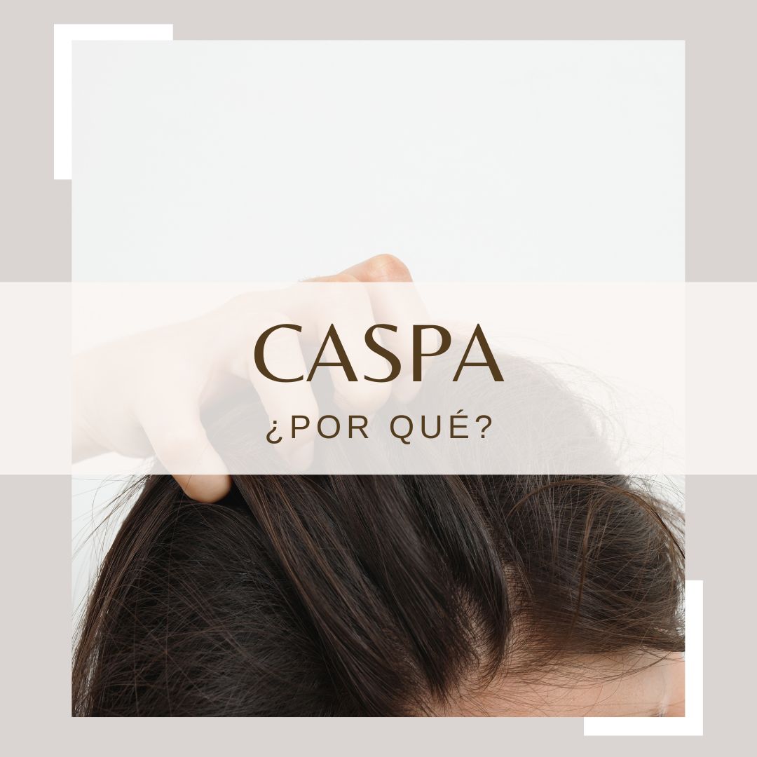 CASPA O DESCAMACIÓN: CAUSAS Elimina la caspa Sin Siliconas